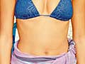 Bauch  Image Source